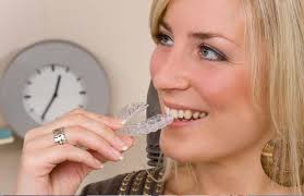 Prozirna folija za ispravljanje zuba