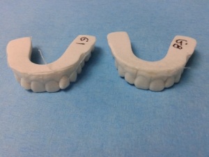 Modeli početnog i idealnog položaja zuba. Za ovaj slučaj je bilo potrebno 8 folija